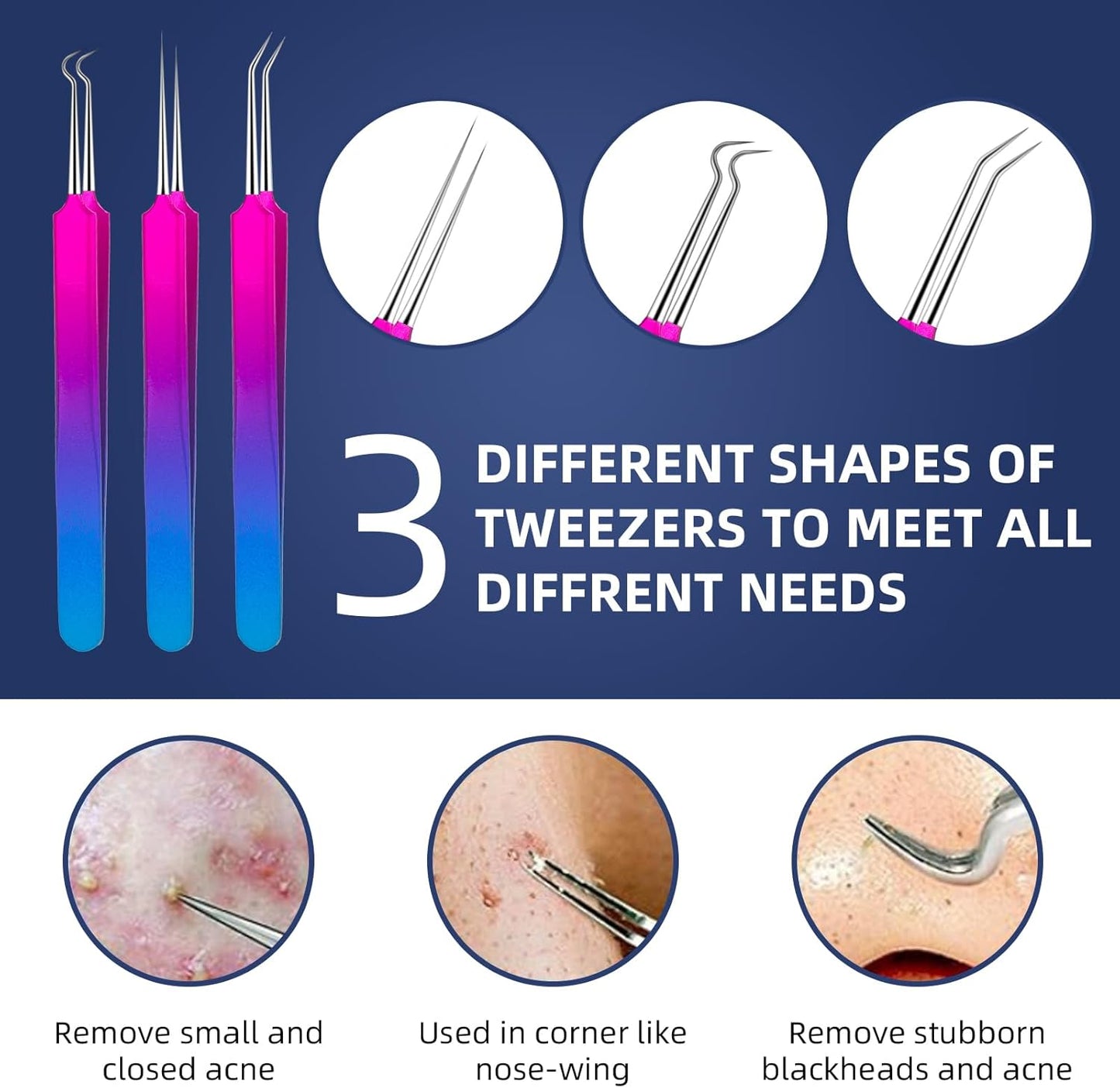 Pimple Popper Tool Kit -  10 Pcs Blackhead Remover Comedone Extractor Kit with Metal Case for Quick and Easy Removal of Blackheads, Zit Removing, Facial and Nose(Colorful)