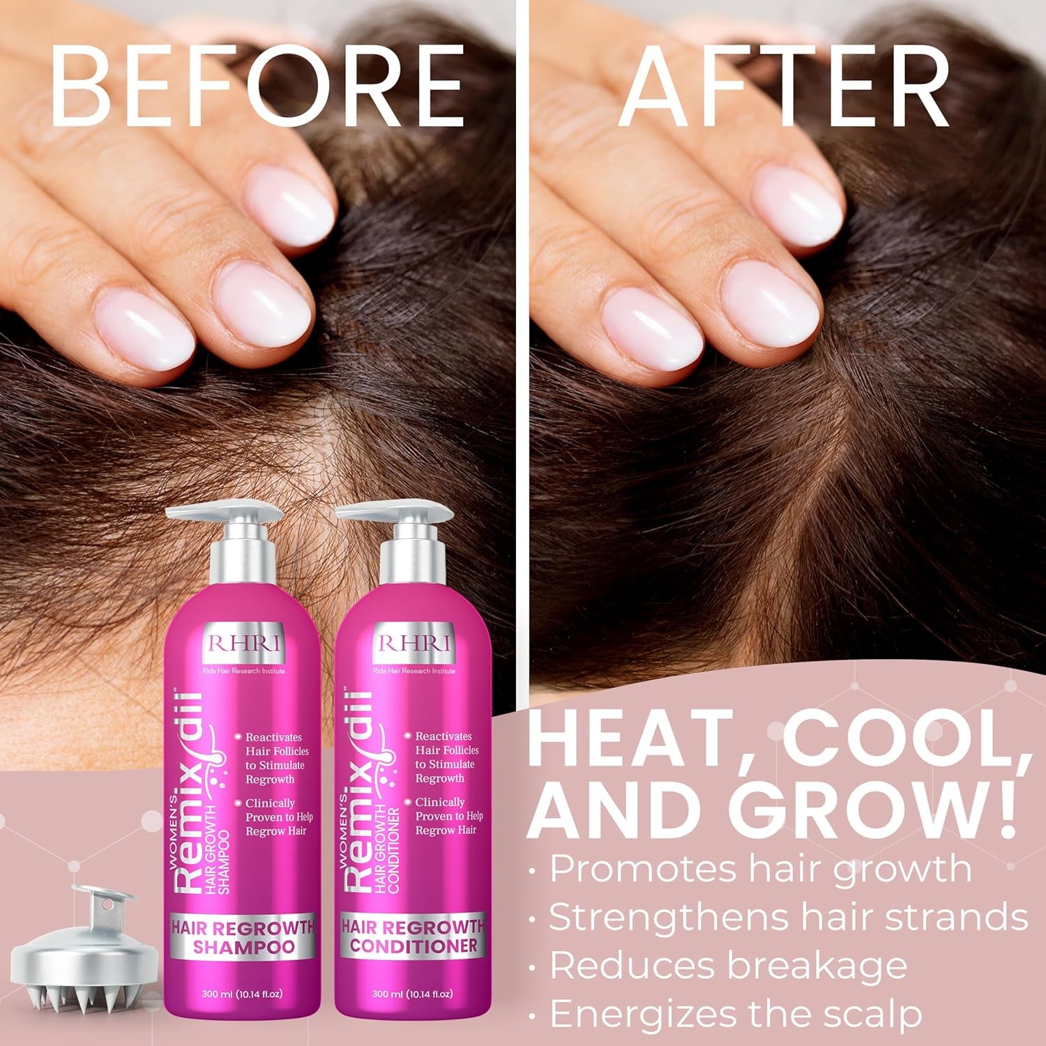 34 OZ Hair Growth Shampoo and Conditioner Set for Women | Effective Hair Regrowth Treatment | Strengthening, Thickening & Soothing Formula for Healthy, Vibrant Hair | Salon Size