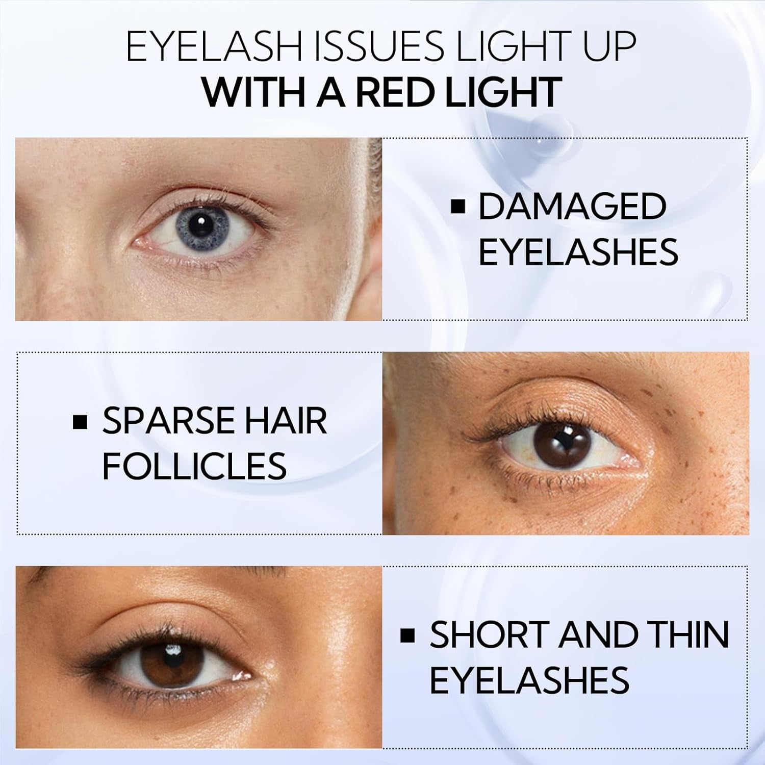 Eyelash Growth Serum, Advanced Eyelash Treatment (Eyelash Growth Serum - B)